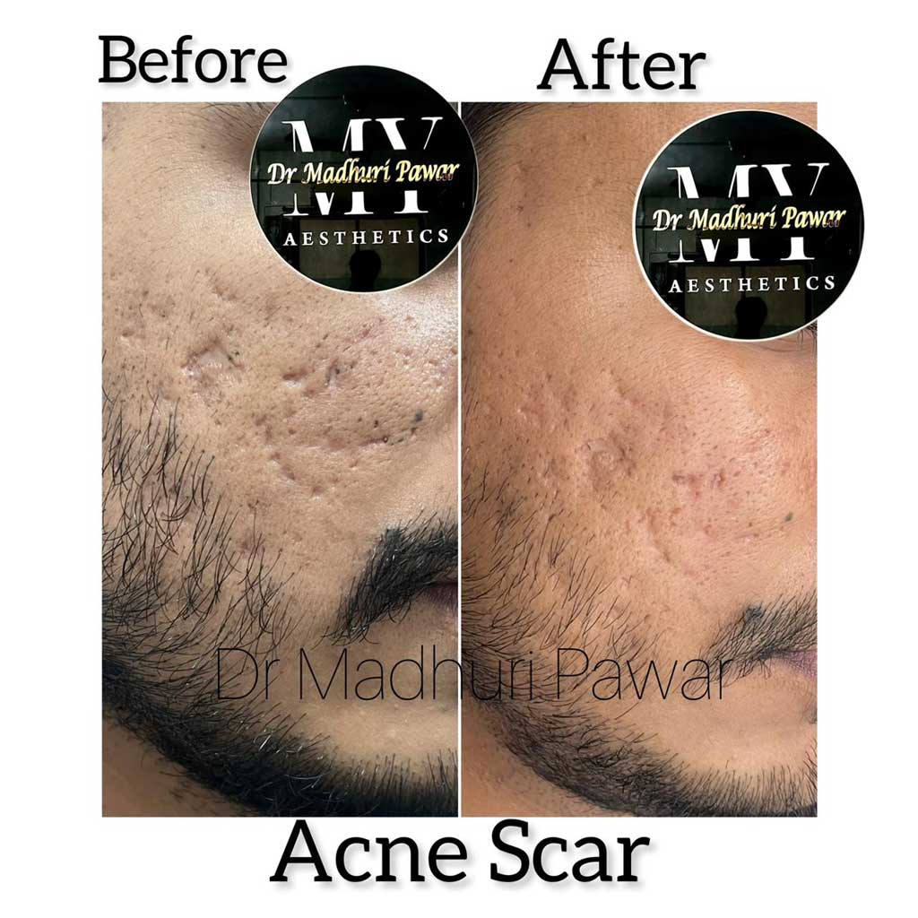 skin-aging