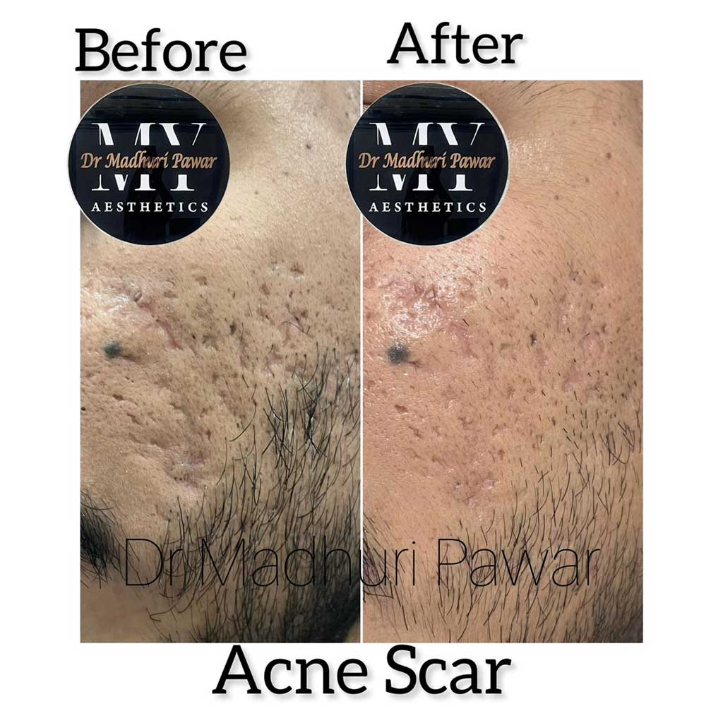 skin-aging