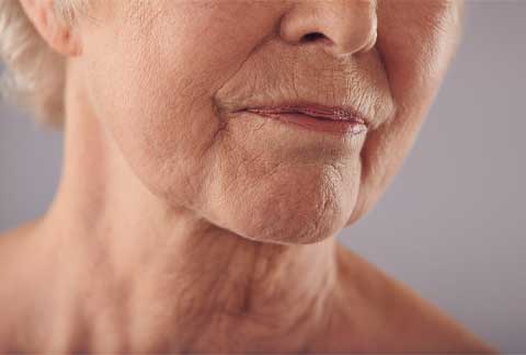 Ageing Neck