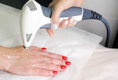 Hand Rejuvenation