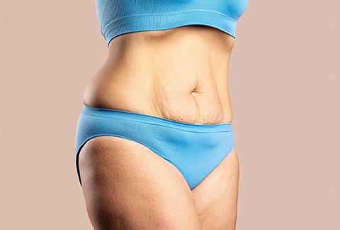 Loose Skin
