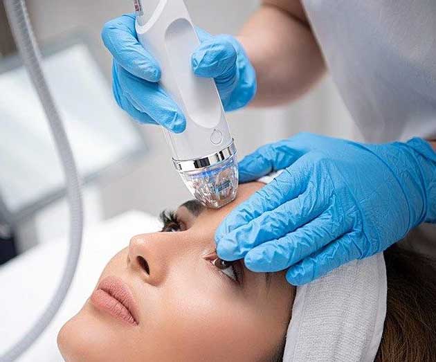 Microneedling RF