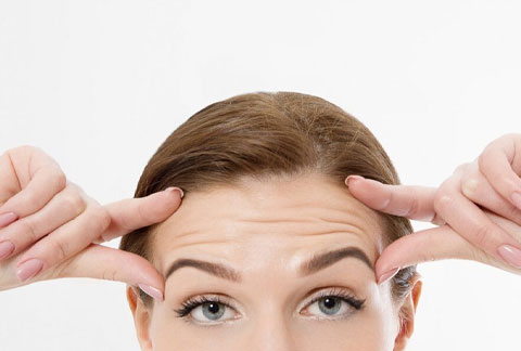 forehead-lines