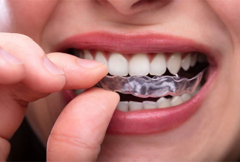 teeth-grinding
