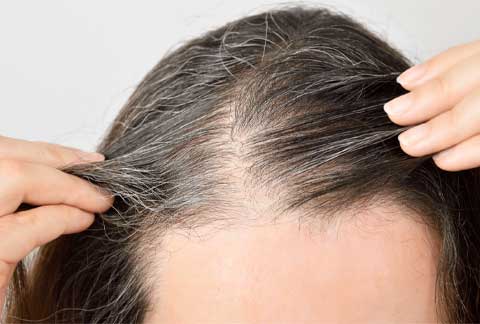 Hair Restoration