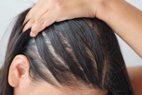Hair Thining