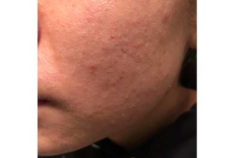 Congested Skin