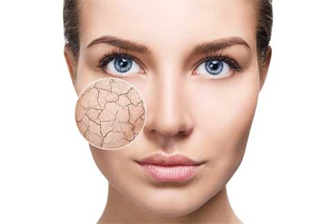 Congested Skin
