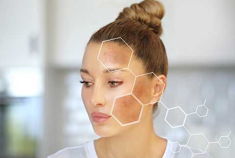 skin-care
