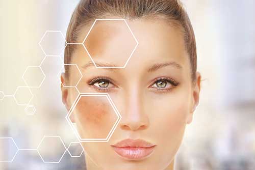 skin-aging