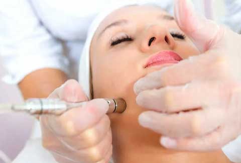 Microdermabrasion