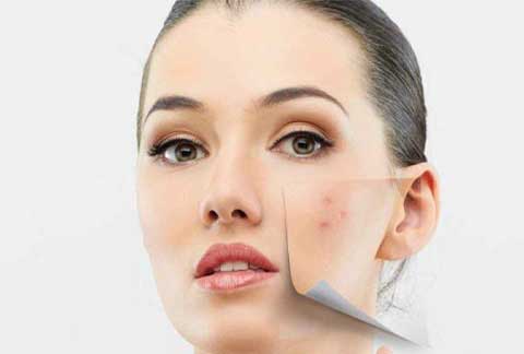 Pigmentation