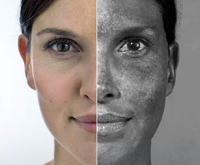skin-aging