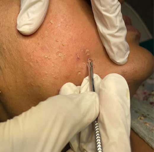 skin-aging