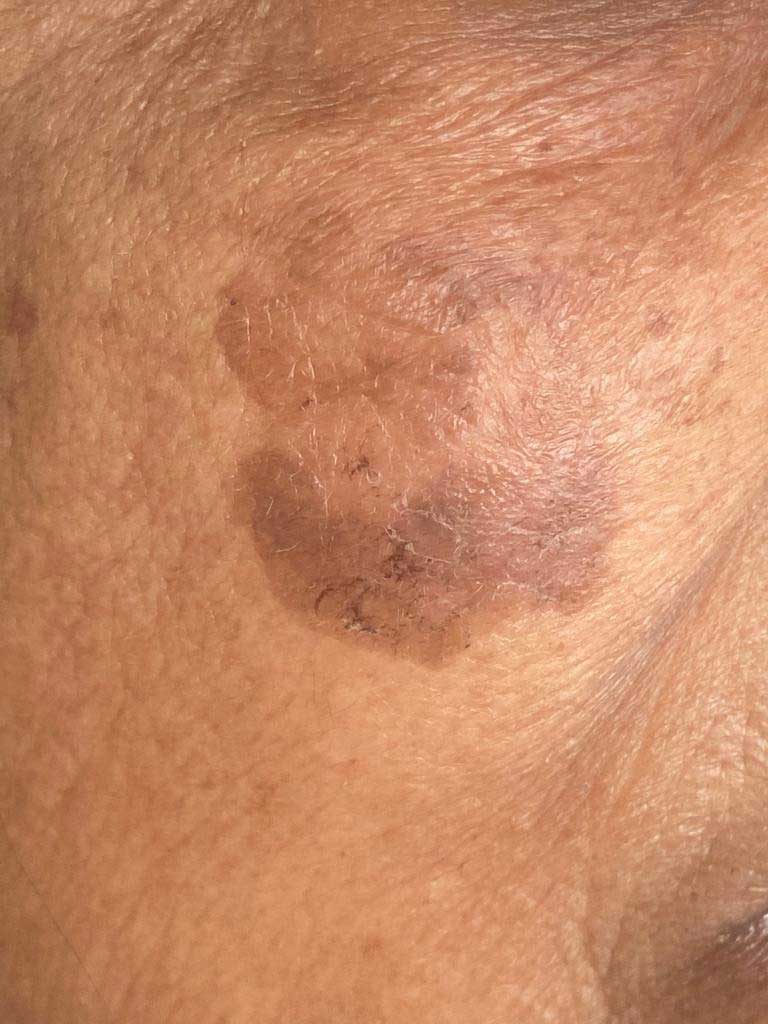 skin-aging